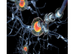 Multiple Sclerosis