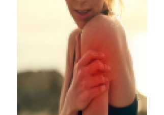 Rheumatoid Arthritis