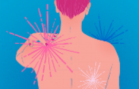 Fibromyalgia